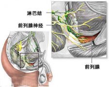前列腺痛怎么治疗好？